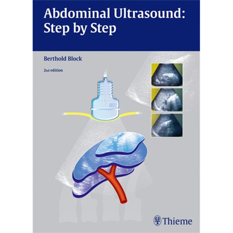 Abdominal Ultrasound: Step by Step